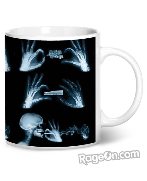 X-Ray Coffee Mug